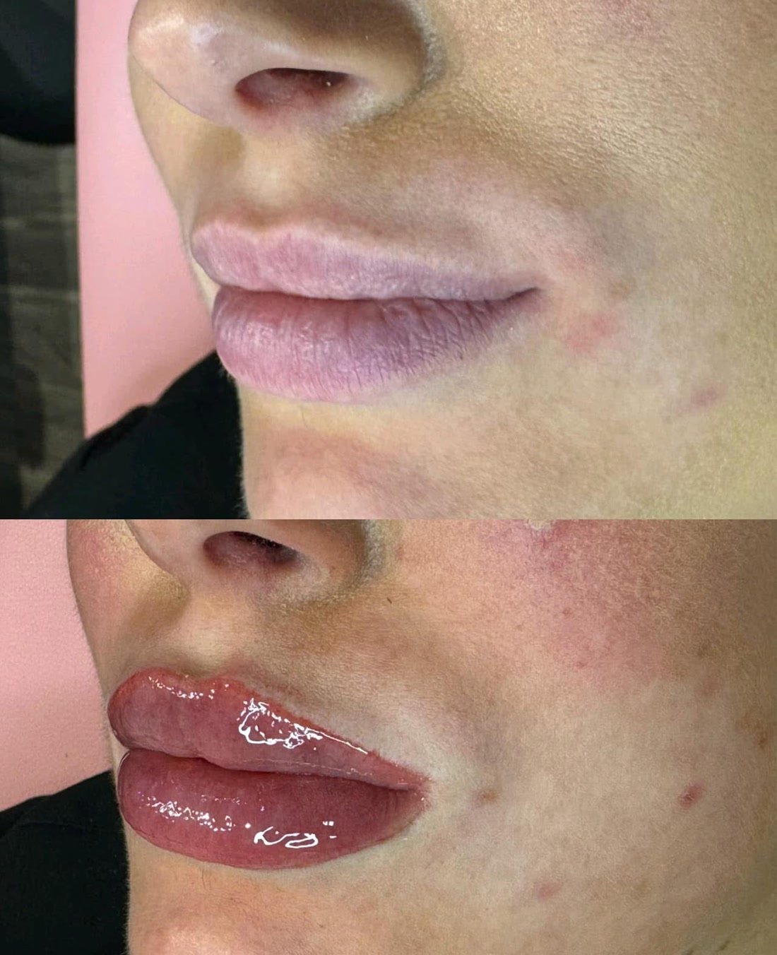 Lip blush permanent makeup, before above and healed below.